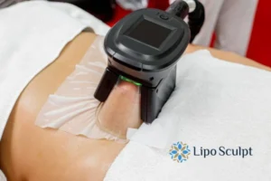 Does Fat Freezing At Home Work? 3 Fat freezing at home from Lipo Sculpt Kent